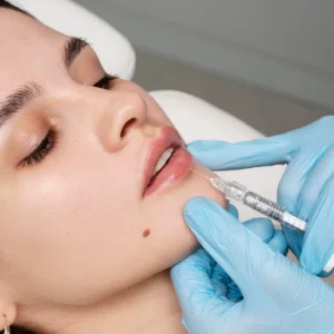 Lip Filler Masterclass