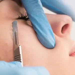 Dermaplaning