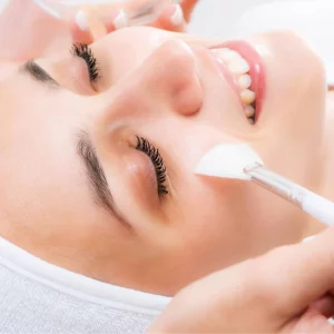 Chemical Peels