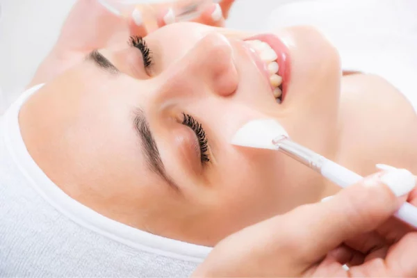 Chemical Peels